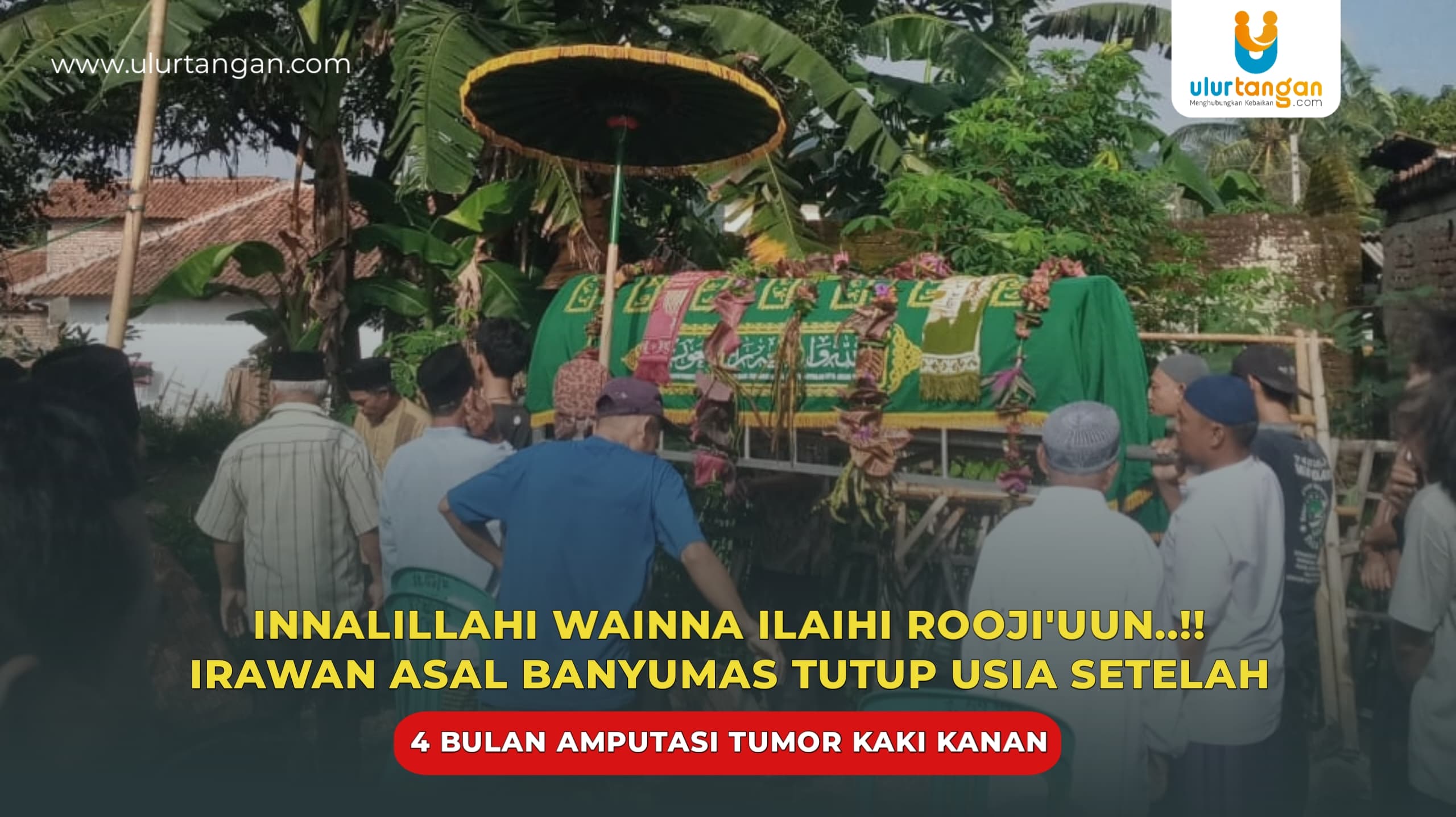 Innalillahi Wainna Ilaihi Rooji’uun..!! Irawan Asal Banyumas Tutup Usia Setelah 4 Bulan Amputasi Tumor Kaki Kanan