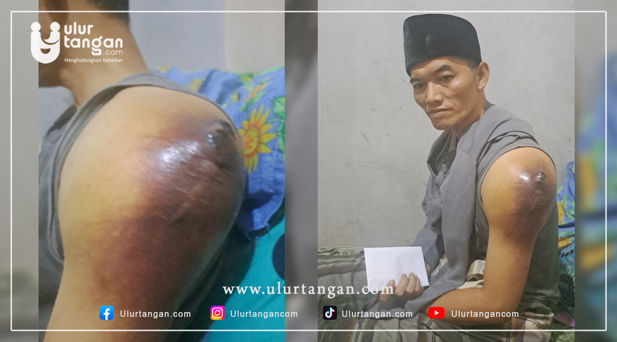 Tumor Terus Membesar Guru Ngaji di Tasikmalaya Tak Berdaya Menahan Sakit Mari Ulurkan Tangan