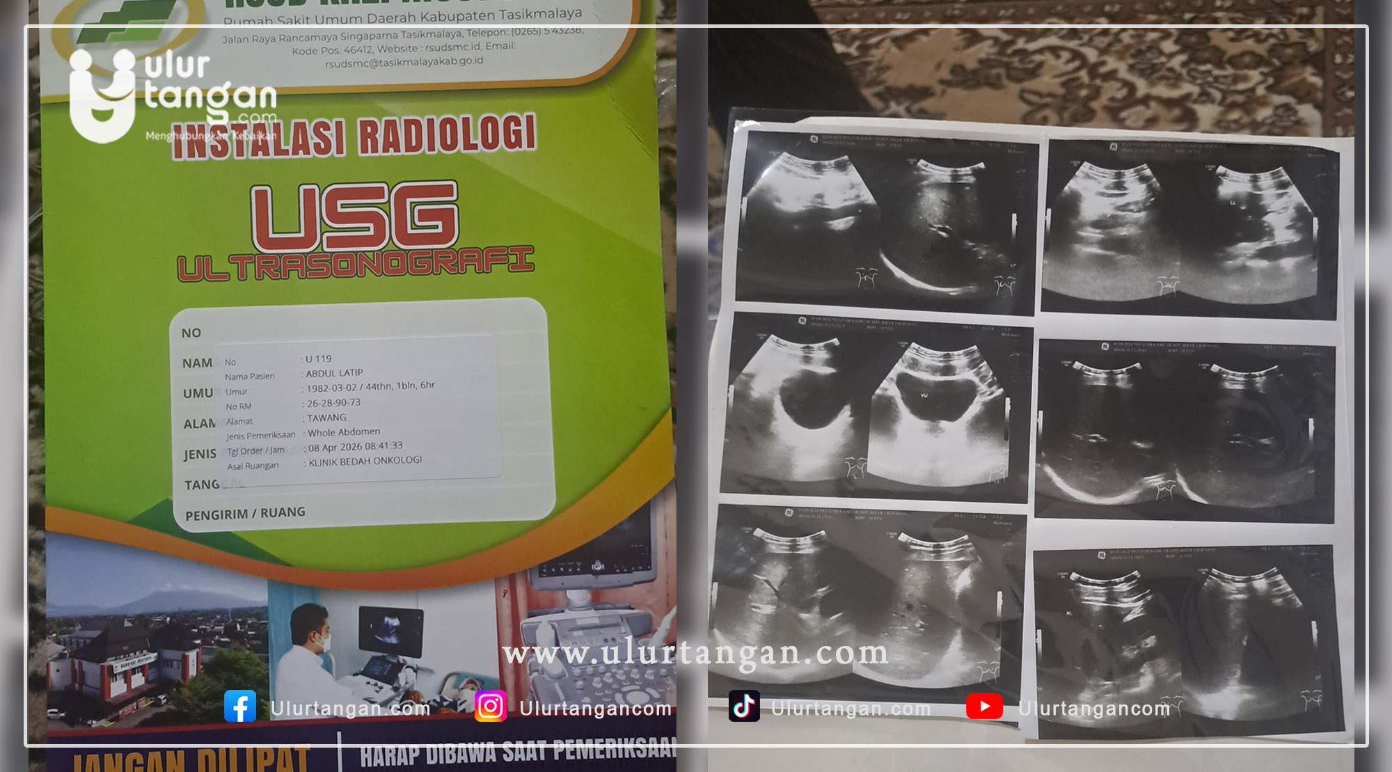 Tumor Terus Membesar Guru Ngaji di Tasikmalaya Tak Berdaya Menahan Sakit Mari Ulurkan Tangan